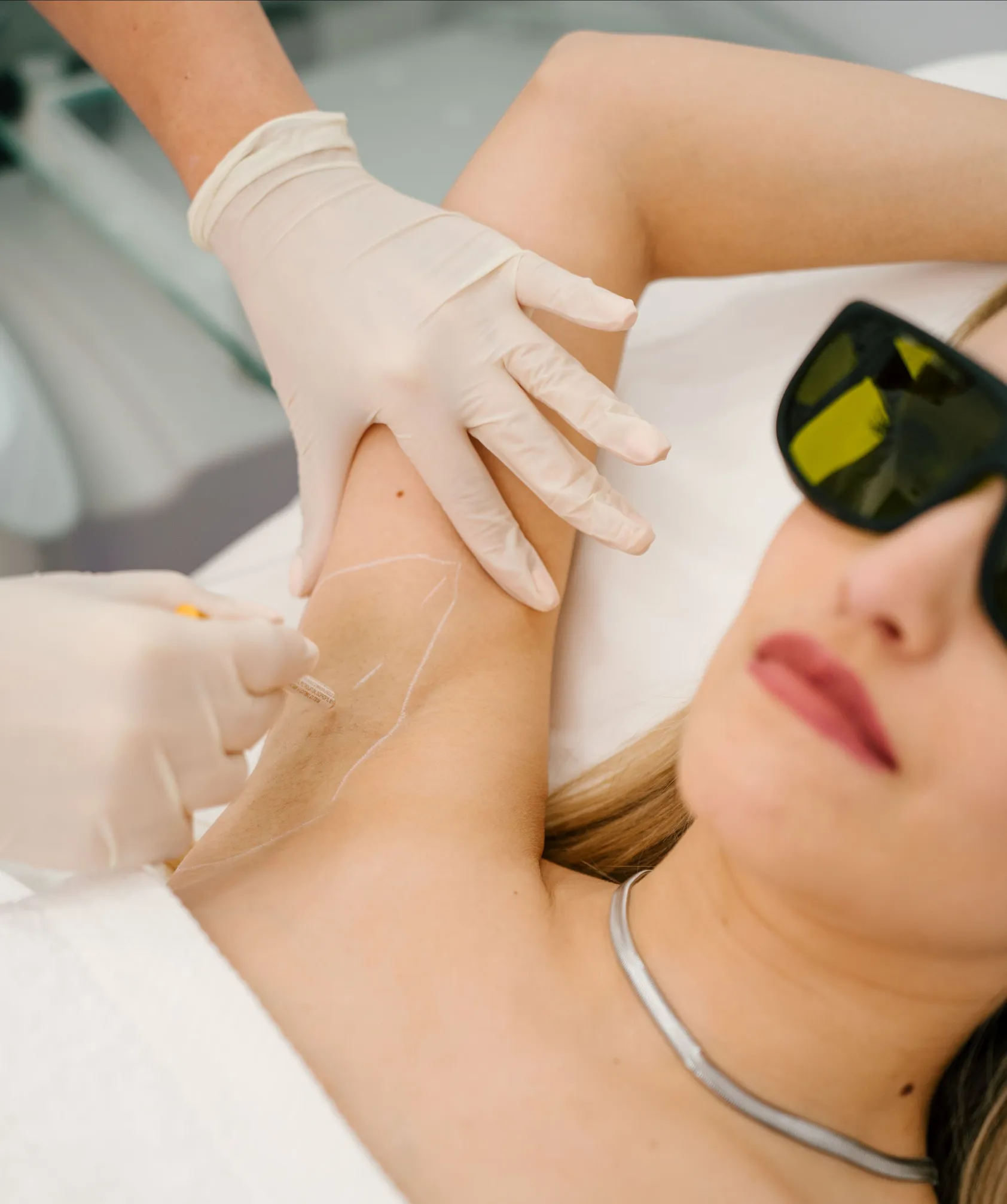 Depiderme professional preparing a client's underarm for laser hair removal